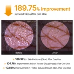 اسپری لایهبردار بدن دکتر ملاکسین مدل Peel Shot حاوی اسید کوجیک و زردچوبه حجم ۹۹ میل